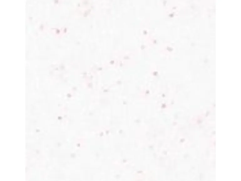 Terralith Buntsteinputz Mosaikputz 1mm -15 kg- BSP1121 Weiss Rosa