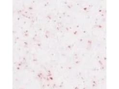 Terralith Buntsteinputz Mosaikputz 1mm -15 kg- BSP1126 Weiss Rot