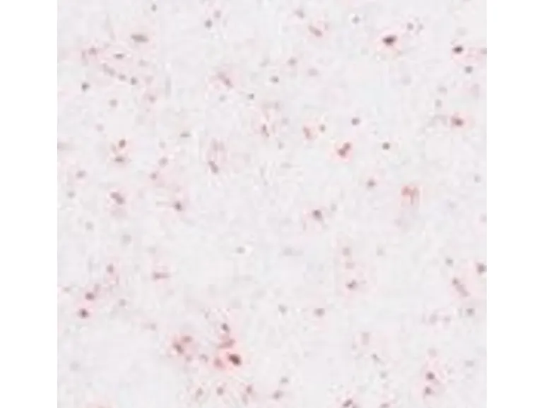 Terralith Buntsteinputz Mosaikputz 1mm -15 kg- BSP1126 Weiss Rot